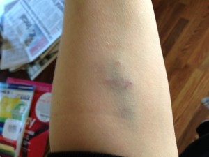 Things That Drive Me Insane-Idiot Nurses